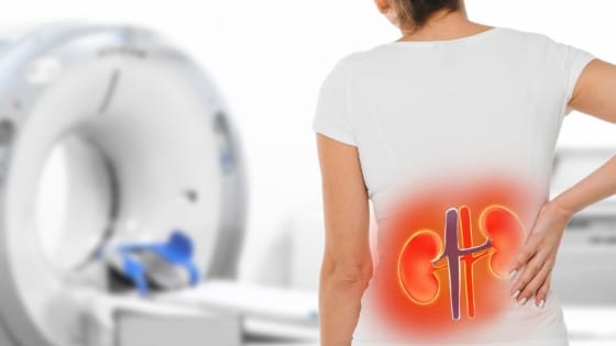 Kidney Health Tips You Can Actually Stick To